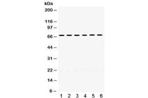 Western blot testing of 1) rat liver, 2) rat lung, 3) mouse liver, 4) mouse lung, 5) human COLO320 and 6) human MCF7 lysate with PDPK1 antibody. (PDPK1 抗体)
