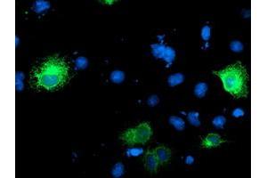 Anti-RPN1 mouse monoclonal antibody (ABIN2455101) immunofluorescent staining of COS7 cells transiently transfected by pCMV6-ENTRY RPN1 (RC201554). (RPN1 抗体)