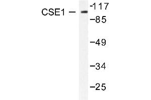 Image no. 2 for anti-CSE1 Chromosome Segregation 1-Like (CSE1L) antibody (ABIN265374) (Exportin 2 抗体)