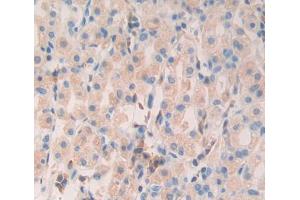Immunohistochemistry (IHC) image for anti-Myosin, Light Chain 6B, Alkali, Smooth Muscle and Non-Muscle (MYL6B) (AA 5-199) antibody (ABIN5013972)