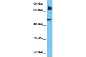 Host:  Rabbit  Target Name:  LRP3  Sample Type:  PANC1 Whole Cell lysates  Antibody Dilution:  1.