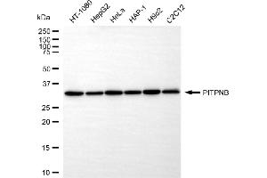 Western blotting analysis using PITPNB antibody (ABIN7799836).