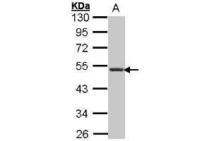 WB Image Sample (30 ug of whole cell lysate) A: Hep G2 , 10% SDS PAGE antibody diluted at 1:1000 (CXCR5 抗体)