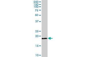 TIMM22 MaxPab polyclonal antibody. (TIMM22 抗体  (AA 1-194))