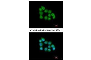 ICC/IF Image Immunofluorescence analysis of paraformaldehyde-fixed A431, using MBNL3, antibody at 1:200 dilution.