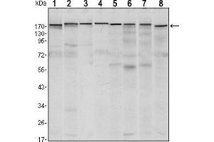 Western blot analysis using SETDB1 mouse mAb against MCF-7 (1),T47D (2), HEK293 (3), JURKAT (4), NIH/3T3 (5), F9 (6), RAW246. (SETDB1 抗体)