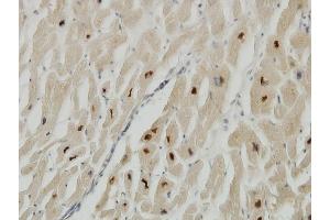 Immunoperoxidase of monoclonal antibody to TTN on formalin-fixed paraffin-embedded human heart. (Titin 抗体  (AA 1-110))