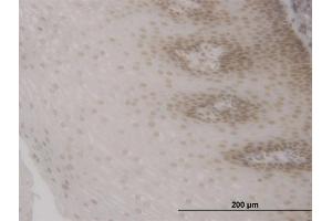 Immunoperoxidase of monoclonal antibody to FOXO3A on formalin-fixed paraffin-embedded human esophagus. (FOXO3 抗体  (AA 361-460))