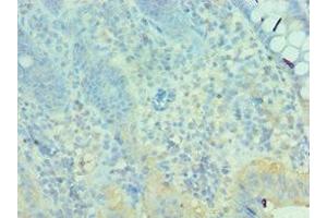 Immunohistochemistry of paraffin-embedded human epityphlon tissue using ABIN7160627 at dilution of 1:100 (MTM1 抗体  (AA 484-603))