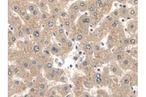 Immunohistochemistry (IHC) image for anti-Keratin 2 (KRT2) (AA 7-160) antibody (ABIN7431878)
