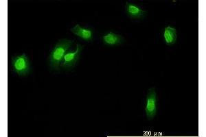Immunofluorescence of monoclonal antibody to WDR61 on HeLa cell. (WDR61 抗体  (AA 1-305))
