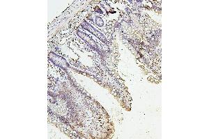 IHC analysis of H1F0 using anti-H1F0 antibody (ABIN7600521).
