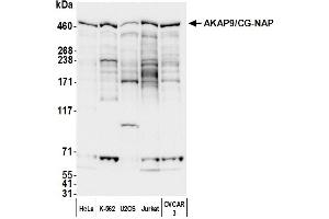 anti-A Kinase (PRKA) Anchor Protein (Yotiao) 9 (AKAP9) (AA 1075-1125) antibody