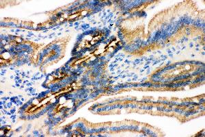 Anti- gamma Catenin Picoband antibody, IHC(P) IHC(P): Mouse Intestine Tissue (JUP 抗体  (AA 556-745))