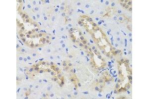 Immunohistochemistry of paraffin-embedded Rat kidney using DISC1 Polyclonal Antibody at dilution of 1:100 (40x lens). (DISC1 抗体)