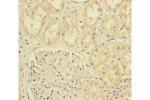 Immunohistochemistry of paraffin-embedded human kidney tissue using ABIN7165835 at dilution of 1:100 (MTO1 抗体  (AA 420-680))