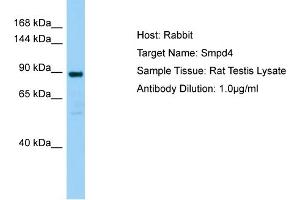 WB Suggested Anti-Smpd4 Antibody   Titration: 1. (SMPD4 抗体  (Middle Region))