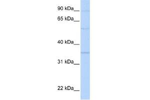 WB Suggested Anti-PHB2 Antibody Titration:  0. (Prohibitin 2 抗体  (N-Term))