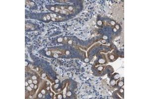 Immunohistochemical staining of human duodenum with CLCA4 polyclonal antibody  shows moderate cytoplasmic positivity in glandular cells at 1:10-1:20 dilution. (CLCA4 抗体)