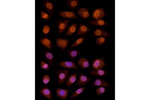 Immunofluorescence analysis of L929 cells using CRYGC antibody (ABIN6130868, ABIN6139079, ABIN6139080 and ABIN6224977) at dilution of 1:100 (40x lens). (CRYGC 抗体  (AA 1-174))