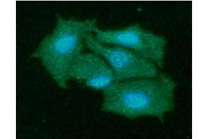 ICC/IF analysis of KIR2DL1 in Hep3B cells line, stained with DAPI (Blue) for nucleus staining and monoclonal anti-human KIR2DL1 antibody (1:100) with goat anti-mouse IgG-Alexa fluor 488 conjugate (Green).