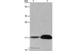 Western blot analysis of Mouse kidney and human kidney tissue, using FHIT Polyclonal Antibody at dilution of 1:600 (FHIT 抗体)
