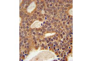 Immunohistochemistry (IHC) image for anti-DNA Cross-Link Repair 1B (DCLRE1B) antibody (ABIN3002342) (DCLRE1B 抗体)