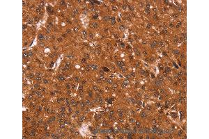 Immunohistochemistry of Human brain  using CCND3 Polyclonal Antibody at dilution of 1:40 (Cyclin D3 抗体)
