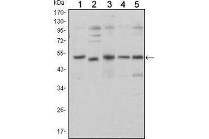 Western blot analysis using SMAD5 mouse mAb against Hela (1), SK-N-SH (2), PC-12 (3), Jurkat (4), and K562 (5) cell lysate. (SMAD5 抗体)