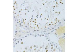 Immunohistochemistry of paraffin-embedded rat testis using Phospho-RELA-S276 antibody (ABIN6003884) at dilution of 1/100 (40x lens). (NF-kB p65 抗体  (pSer276))