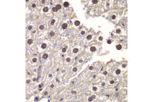 Immunohistochemistry of paraffin-embedded mouse liver using ST14 antibody at dilution of 1:200 (400x lens). (ST14 抗体)