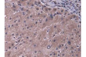DAB staining on IHC-P; Samples: Human Liver Tissue (ABCB11 抗体  (AA 421-663))