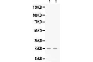Western blot analysis of GRO gamma expression in mouse lung extract ( Lane 1) and mouse spleen extract ( Lane 2). (CXCL3 抗体  (AA 32-100))