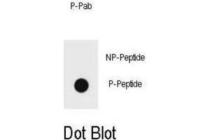 Dot Blot (DB) image for anti-Receptor tyrosine-protein kinase erbB-2 (ErbB2/Her2) (pThr1166) antibody (ABIN3001983)