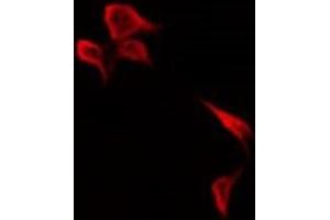 ABIN6278690 staining HepG2 by IF/ICC. (KR1_HHV11 抗体)