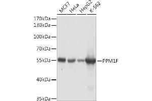 Western blot analysis of extracts of various cell lines, using PPM1F Rabbit pAb (ABIN7269682) at 1:1000 dilution. (PPM1F 抗体  (AA 1-190))