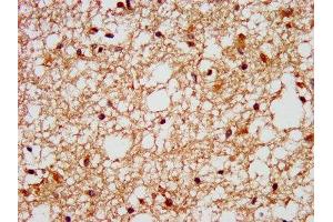 IHC image of ABIN7153159 diluted at 1:400 and staining in paraffin-embedded human brain tissue performed on a Leica BondTM system. (FFAR1 抗体  (AA 143-178))