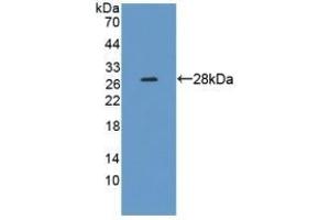 Detection of Recombinant CRMP1, Human using Polyclonal Antibody to Collapsin Response Mediator Protein 1 (CRMP1) (CRMP1 抗体  (AA 1-250))
