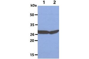 The Cell lysates (40ug) were resolved by SDS-PAGE, transferred to PVDF membrane and probed with anti-human SBDS antibody (1:3000). (SBDS 抗体)