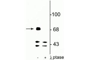 Western blot of rat hippocampal lysate showing specific immunolabeling of the ~71 kDa FMRP protein phosphorylated at Ser499 in the first lane (-). (FMR1 抗体  (pSer499))