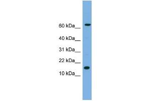 WB Suggested Anti-IL1B Antibody Titration: 0.