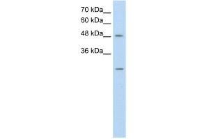 WB Suggested Anti-ANKRD2 Antibody Titration:  0. (ANKRD2 抗体  (N-Term))