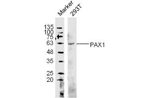 (Human Cell line) 293T lysates probed with PAX1 Polyclonal Antibody, unconjugated  at 1:300 overnight at 4°C followed by a conjugated secondary antibody at 1:10000 for 60 minutes at 37°C. (PAX1 抗体  (AA 151-250))