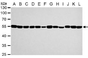 Western Blotting (WB) image for anti-Tubulin, alpha 1a (Tuba1a) antibody (ABIN2856707)