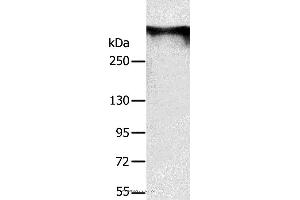 Western blot analysis of Mouse brain tissue, using RYR1 Polyclonal Antibody at dilution of 1:300 (RYR1 抗体)