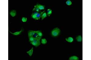 Immunofluorescence staining of MCF-7 cells with ABIN7142736 at 1:83, counter-stained with DAPI. (RPL11 抗体  (AA 3-178))