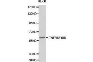 Western Blotting (WB) image for anti-Tumor Necrosis Factor Receptor Superfamily, Member 10b (TNFRSF10B) antibody (ABIN1875126) (TNFRSF10B 抗体)