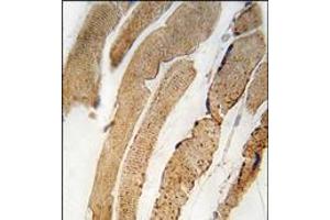 Formalin-fixed and paraffin-embedded human skeletal muscle tissue reacted with PDK4 antibody (Center), which was peroxidase-conjugated to the secondary antibody, followed by DAB staining. (PDK4 抗体  (Middle Region))