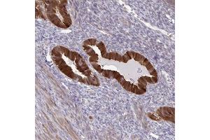 Immunohistochemical staining of human uterus with CMPK1 polyclonal antibody  shows strong cytoplasmic positivity in glandular cells at 1:50-1:200 dilution. (Cytidine Monophosphate (UMP-CMP) Kinase 1, Cytosolic (CMPK1) 抗体)