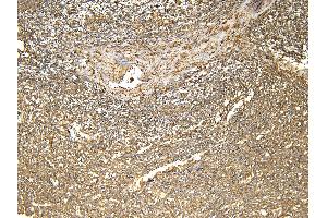 Immunohistochemistry (IHC) image for anti-Ferritin, Light Polypeptide (FTL) (C-Term) antibody (ABIN334402)